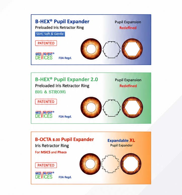 Pupil Expansion Redefined